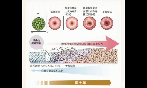 脚泡水里泡烂了用药可以吗-脚丫泡水后烂擦什么药-脚泡烂了用什么药,中国脚泡水里泡烂了用药网站